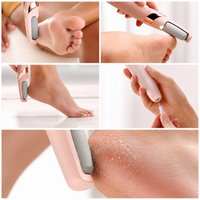 Pedicure Feet Callus Remover Tool image 3